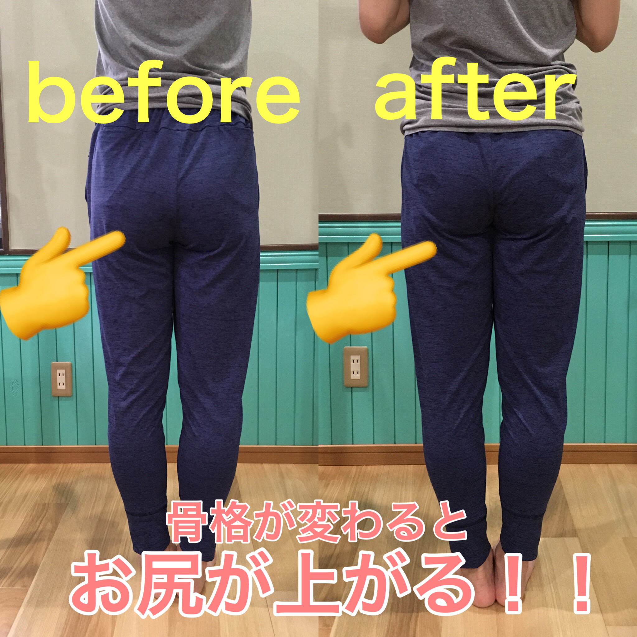Before After 事例2